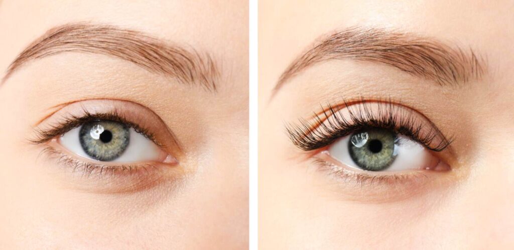 Tips for Promoting Healthy and Speedy Eyelash Regrowth